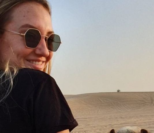 King Of Dubai Offers to Cover all the Medical Expenses For a Woman Who Fell Off a Horse Rebecca Chisholm
